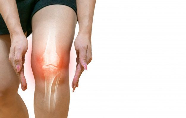 Rodilla